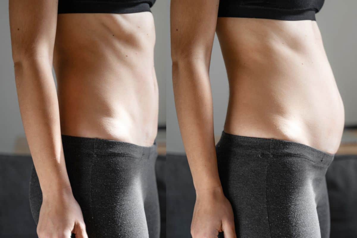 How long does diastasis recti take to improve Southgate?