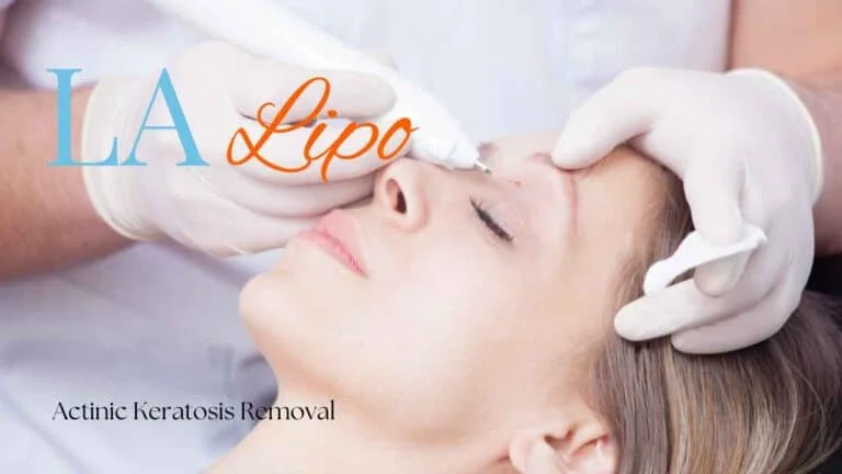Woman receiving Actinic Keratosis Removal Treatment Southgate