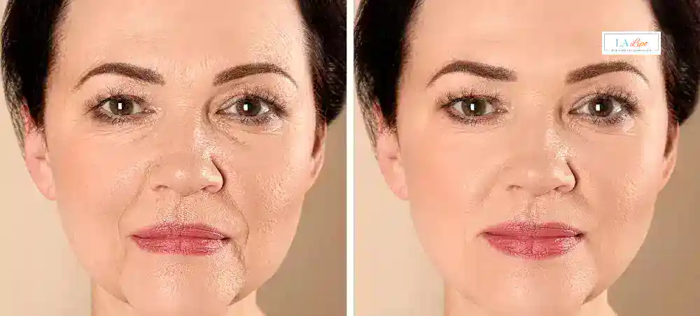 Why Aren’t My Skincare Products Making My Sagging Skin Look Firmer Southgate?