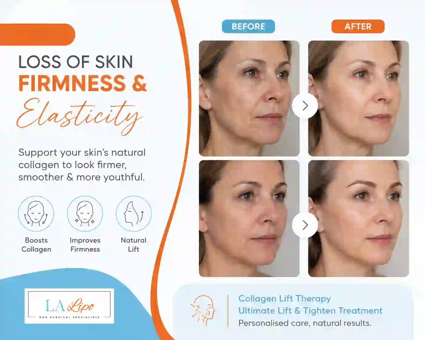 Sign #7: Loss of Skin Firmness and Elasticity Southgate