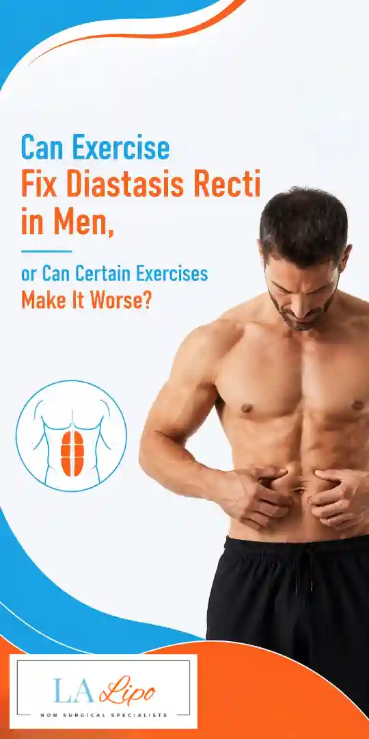Can Exercise Fix Diastasis Recti in Men, or Can Certain Exercises Make It Worse Southgate?